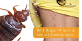 bedbugs very dangers pest effected yor faimily skin bady and more 
